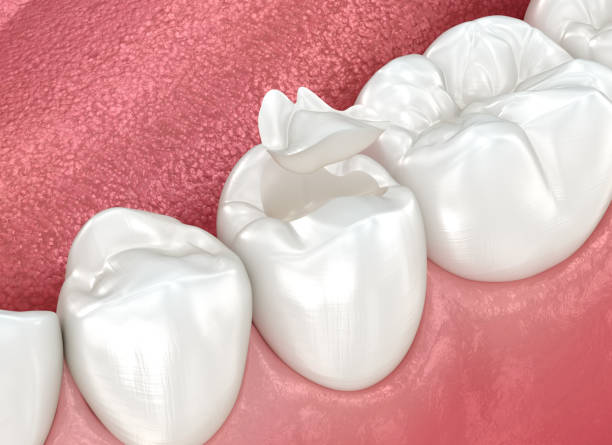 Best Dentures (Full and Partial)  in Dayton, TX